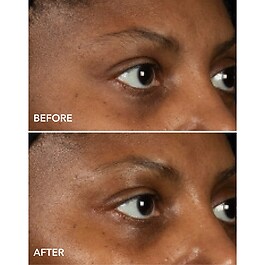 DermInfusions Augenkonturenmaske Lifting + Regeneration